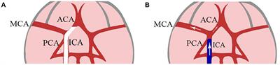 Updates on Selective Brain Hypothermia: Studies From Bench Work to Clinical Trials